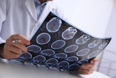 Dottore controlla risonanza cervello testa