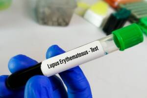 Lupus campione di sangue