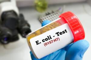 Escherichia coli