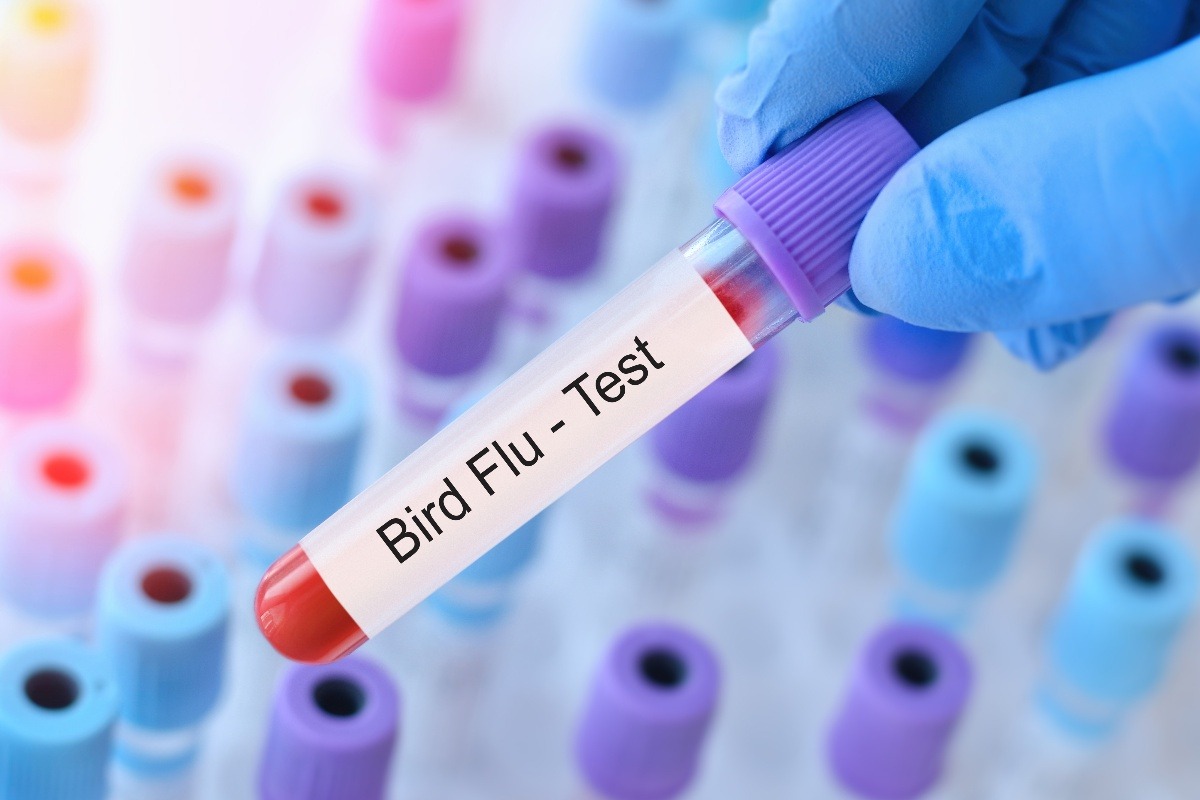 provetta per un test per l'influenza aviaria