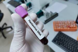 provetta campione con sangue per test Hantavirus