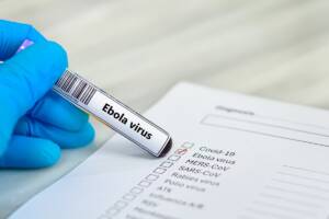 provetta con test per il virus dell'Ebola