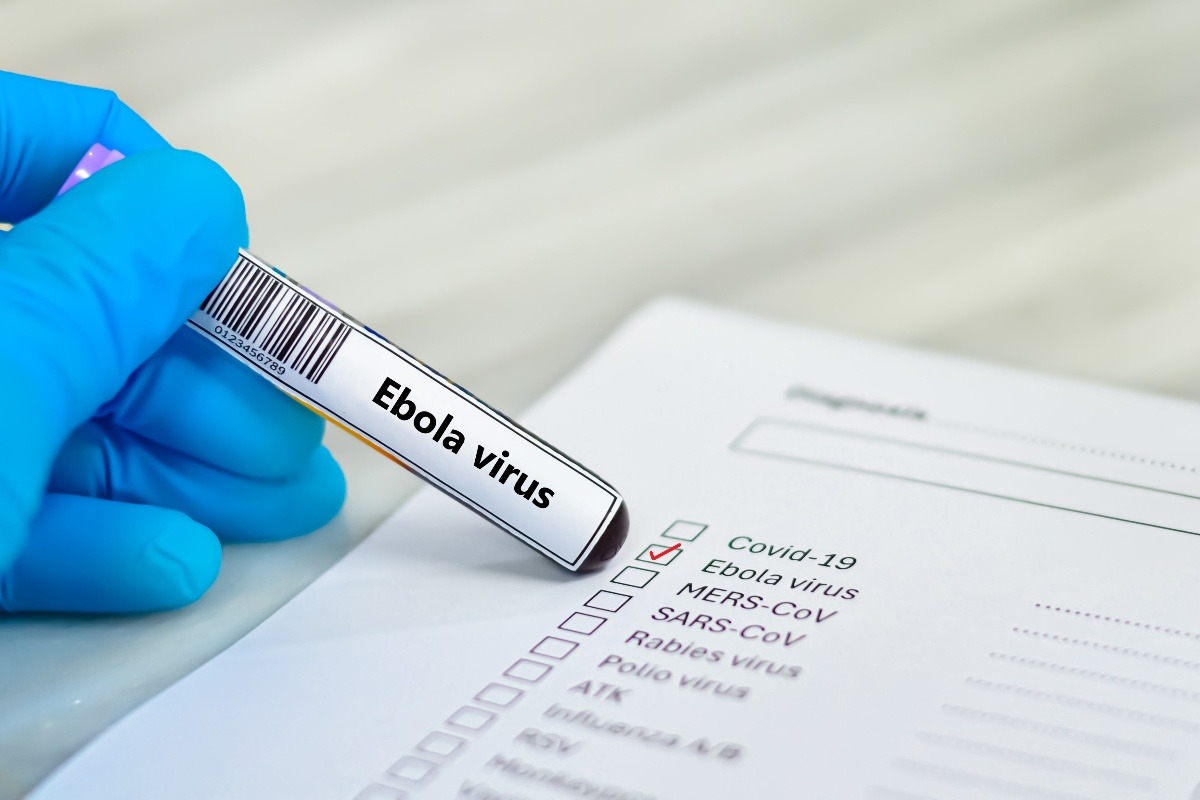 provetta con test per il virus dell'Ebola