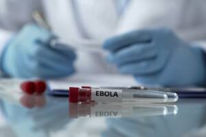 provetta per test per Ebola