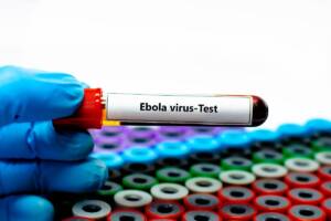 provetta con test per il virus dell'Ebola
